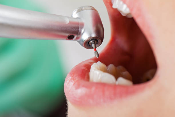 Best Emergency Root Canal Therapy in Avilla, AR